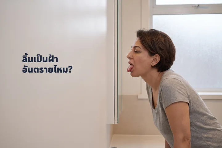 ลิ้นเป็นฝ้าอันตรายไหม? — ผู้หญิงส่องกระจกในห้องน้ำตอนฟ้าสาง มองลิ้นตัวเอง